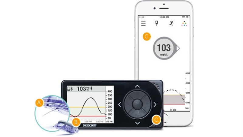 Dexcom G5-